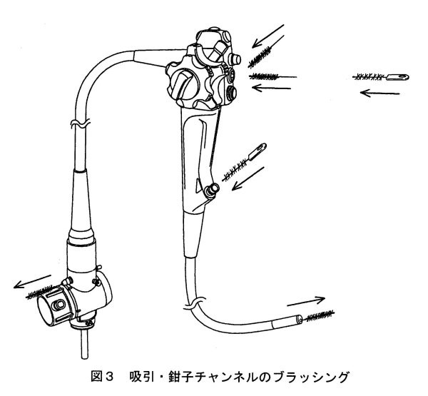 洗浄 方法 胃